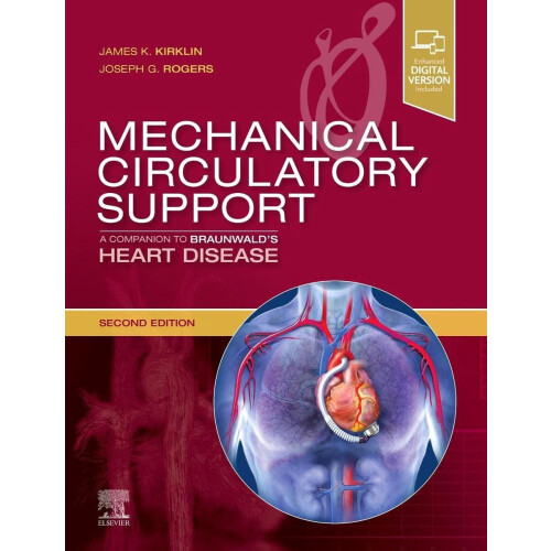 Mechanical Circulatory Support - Companion to Braunwald's Heart Disease - Hardcover - 314 pagina's